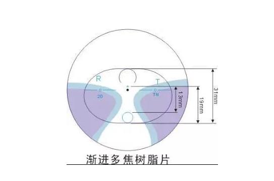 美麗島多焦鏡適合的人群，需要注意的事項